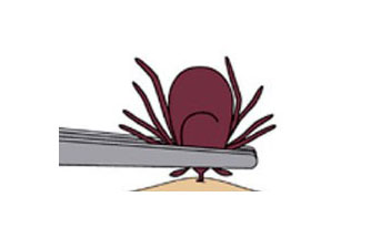                  Tick removal diagram - www.cdc.gov